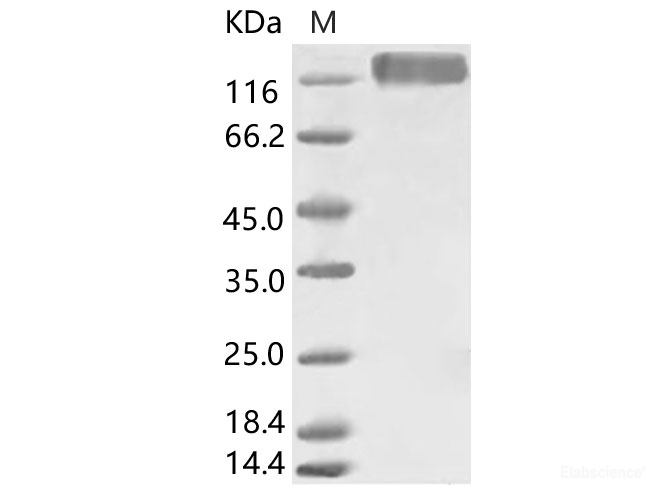 Recombinant HCoV-229E S1+S2 Protein (ECD, His Tag)