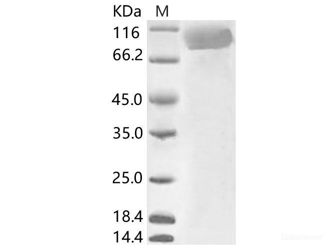 Recombinant HCoV-229E S1 Protein (His Tag)