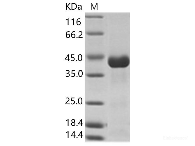 Recombinant  CHIKV (strain SL-CK1) Envelope 2 Protein (His Tag)