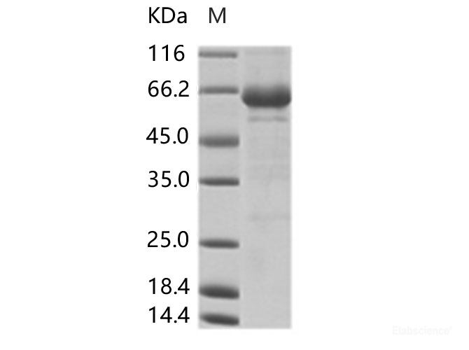 Recombinant Cox A16 (strain G-10) VP1 Protein (Fc Tag)
