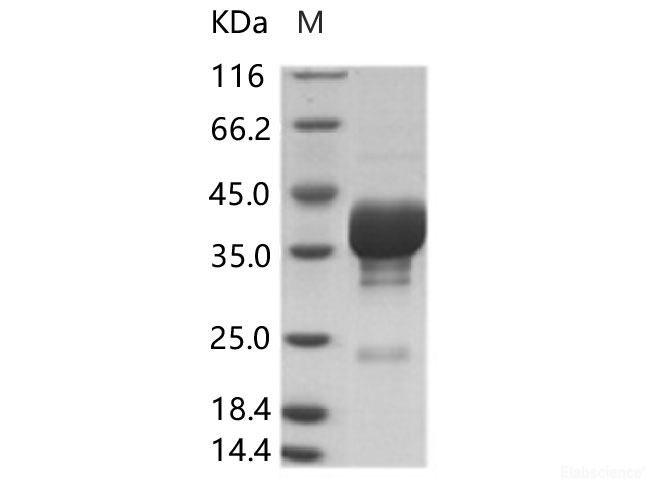 Recombinant Cox A16 (strain G-10) VP4 Protein (Fc Tag)