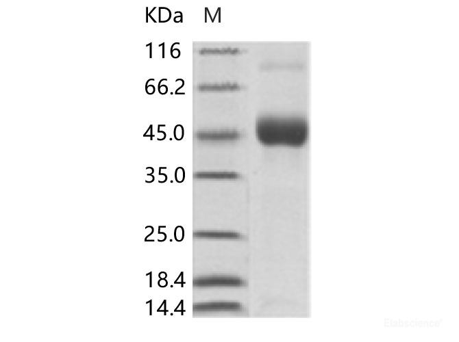 Recombinant DENV (type 1, strain US/Hawaii/1944) DENV-NS1 Protein (His Tag)