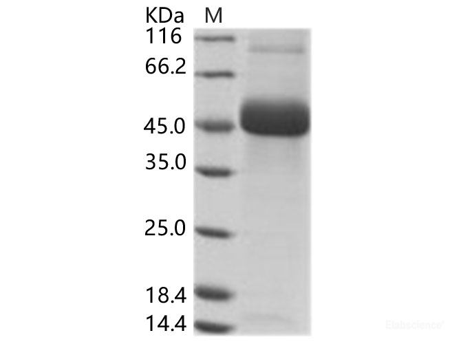 Recombinant DENV (type 2, strain New Guinea C) NS1 Protein (His Tag)