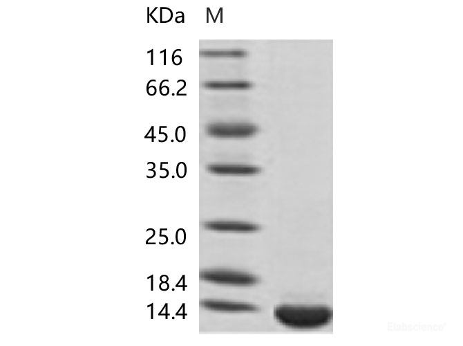 Recombinant DENV (type 2, strain New Guinea C/PUO-218 hybrid) E / Envelope Protein (Domain III, His Tag)