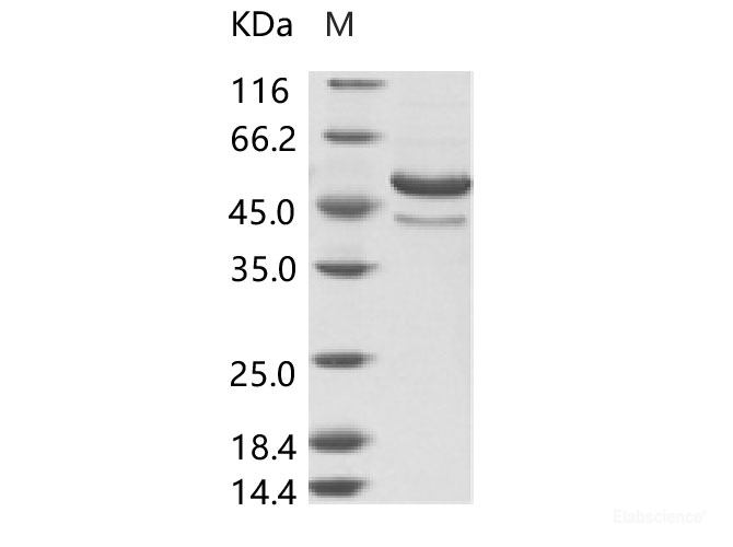 Recombinant DENV (type 2, strain New Guinea C/PUO-218 hybrid) E / Envelope Protein (ECD, His Tag)