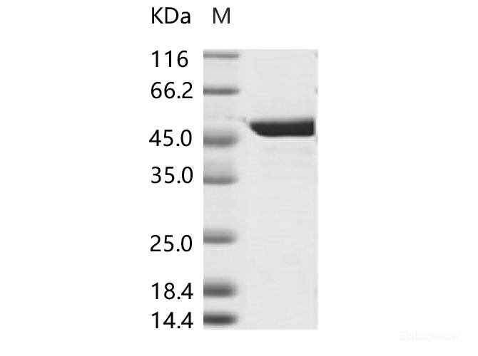 Recombinant DENV (type 2, strain New Guinea C/PUO-218 hybrid) E / Envelope Protein (His Tag)