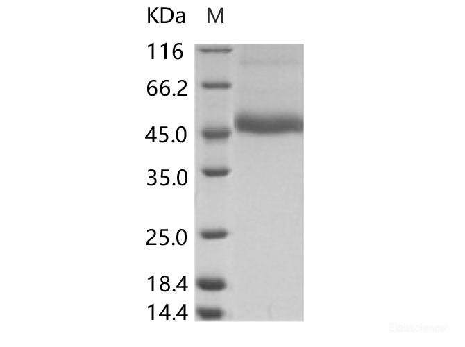 Recombinant DENV (type 3, strain Philippines/H87/1956) NS1 Protein (His Tag)