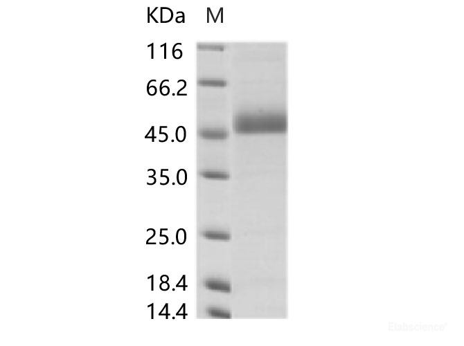 Recombinant DENV (type 4, strain Philippines/H241/1956) NS1 Protein (His Tag)