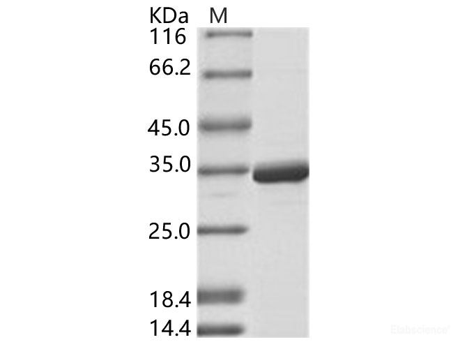 Recombinant DENV-2 (strain New Guinea C) NS5 (methyltransferase domain) / Nonstructural protein 5 Protein (His Tag)
