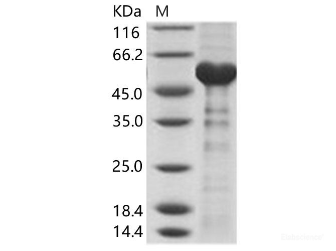 Recombinant Dromedary camel coronavirus (DcCoV)(strain HKU23-368F) Nucleoprotein / DcCoV-NP Protein (His Tag)