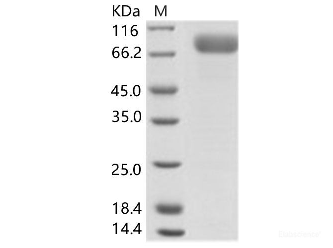 Recombinant EBOV (subtype Bundibugyo, strain Uganda 2007) Glycoprotein / GP-RBD Protein (Fc Tag)