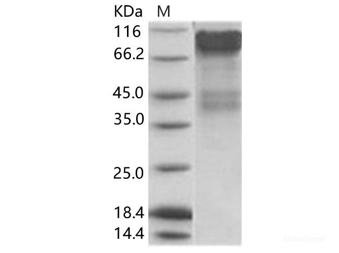 Recombinant EBOV (subtype Bundibugyo, strain Uganda 2007) GP1 / Glycoprotein Protein (His Tag)