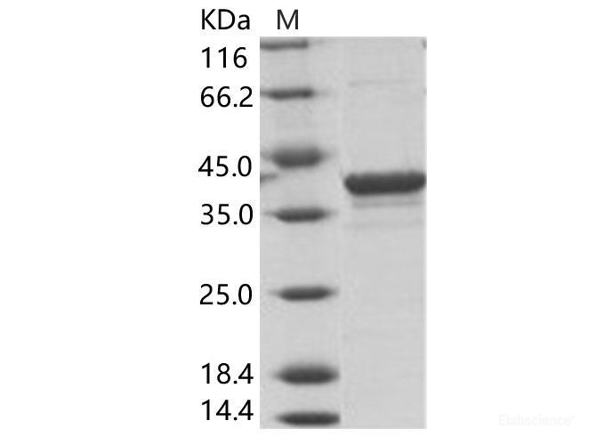 Recombinant EBOV (subtype Bundibugyo, strain Uganda 2007) VP40 / Matrix protein VP40 Protein (His Tag)