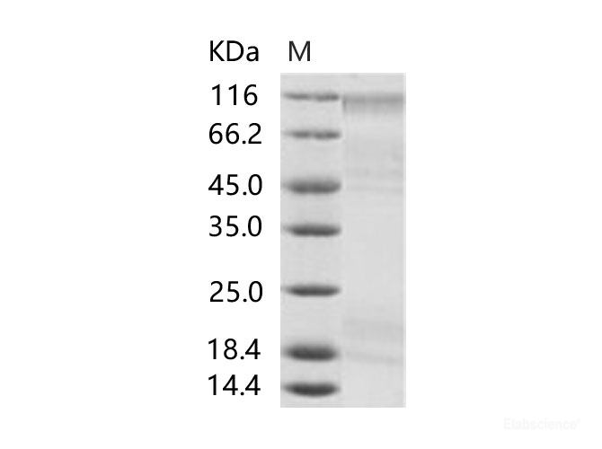 Recombinant EBOV (Subtype Sudan, strain Gulu) Glycoprotein / GP Protein (aa:Met1-Asn637, His Tag)