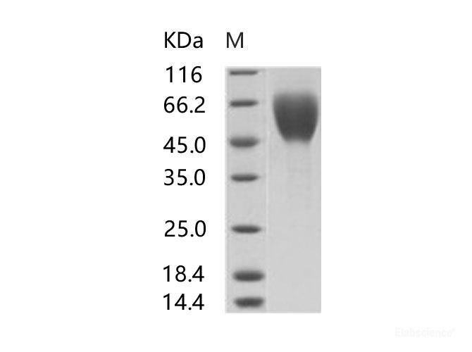 Recombinant EBOV (Subtype Sudan, strain Gulu) Glycoprotein / GP1 (mucin domain deleted) Protein (His Tag)