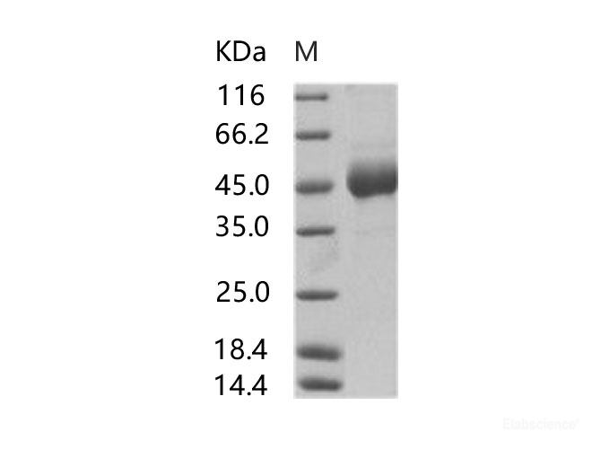 Recombinant EBOV (Subtype Sudan, strain Gulu) Glycoprotein / GP1 (mucin domain deleted) Protein (His Tag)
