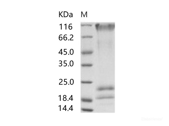 Recombinant EBOV (subtype Sudan, strain Gulu) GP / Glycoprotein Protein (His Tag)