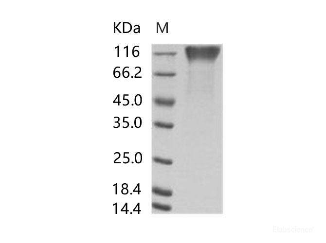 Recombinant EBOV (subtype Sudan, strain Gulu) GP1 / Glycoprotein Protein (His Tag)