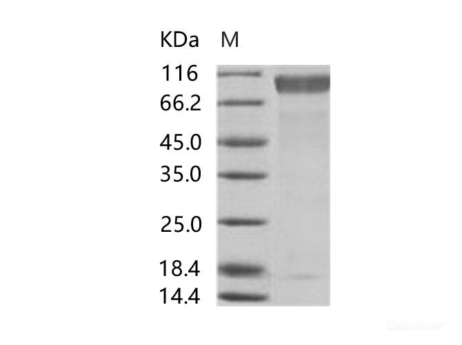Recombinant EBOV (subtype Sudan, strain Gulu) GP1 / Glycoprotein Protein (His Tag)