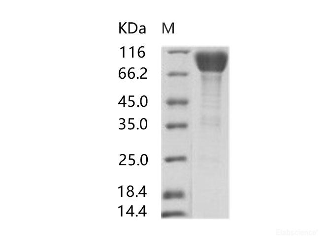 Recombinant EBOV (subtype Sudan, strain Gulu) GP-RBD / Glycoprotein Protein (Fc Tag)