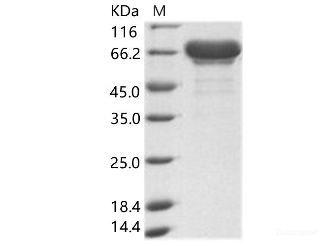 Recombinant EBOV (subtype Sudan, strain Gulu) VP40 / Matrix protein VP40 Protein (His & MBP Tag)