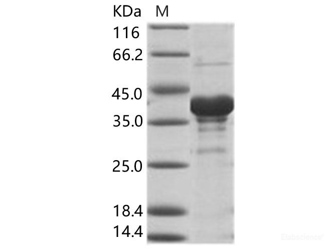 Recombinant EBOV (subtype Sudan, strain Gulu) VP40 / Matrix protein VP40 Protein (His Tag)