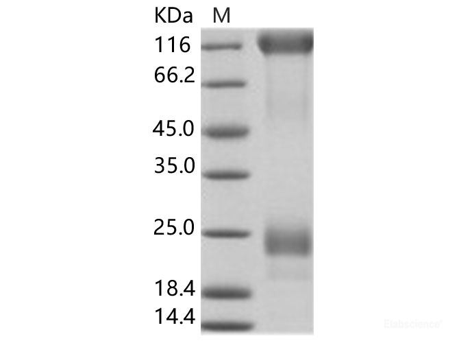 Recombinant EBOV (subtype Zaire, strain Ebola virus H.sapiens-wt/SLE/2014/ManoRiver-G3686.1) Glycoprotein Protein (His Tag)