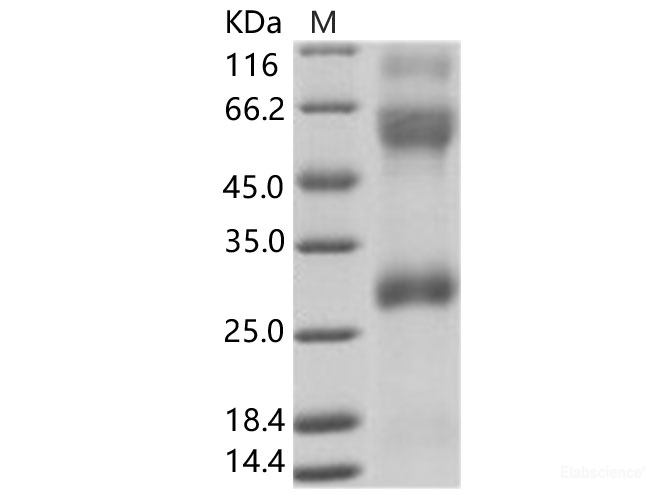 Recombinant EBOV (subtype Zaire, strain H.sapiens-wt/GIN/2014/Kissidougou-C15) Glycoprotein / GP (Virion spike glycoprotein) Protein (His Tag)