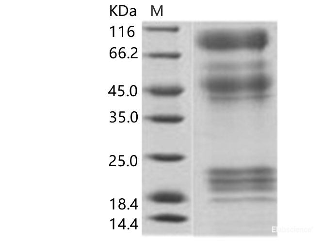 Recombinant EBOV (subtype Zaire, strain H.sapiens-wt/GIN/2014/Kissidougou-C15) Glycoprotein / GP Protein (His Tag)