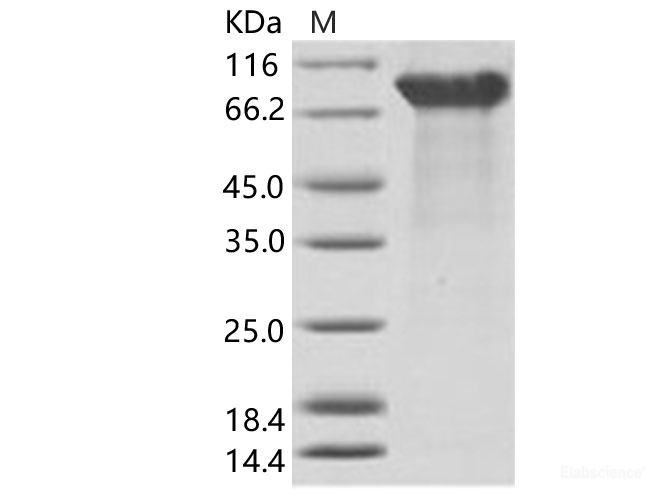 Recombinant EBOV (subtype Zaire, strain H.sapiens-wt/GIN/2014/Kissidougou-C15) Glycoprotein / GP1 Protein (His Tag)