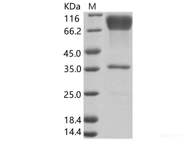 Recombinant EBOV (subtype Zaire, strain H.sapiens-wt/GIN/2014/Kissidougou-C15) Glycoprotein / GP-RBD Protein (Fc Tag)