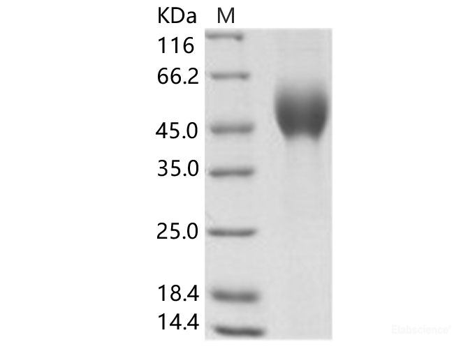 Recombinant EBOV (subtype Zaire, strain H.sapiens-wt/GIN/2014/Kissidougou-C15) Glycoprotein / GP-RBD Protein (His Tag)