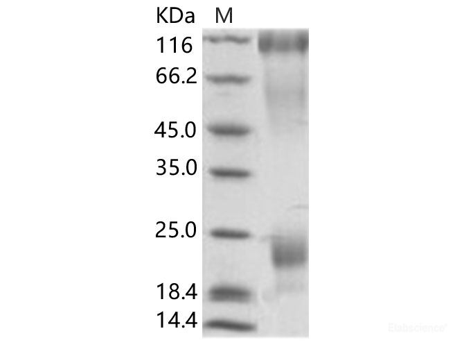 Recombinant EBOV (subtype Zaire, strain H.sapiens-wt/GIN/2014/Kissidougou-C15) GP / Glycoprotein Protein (His Tag)