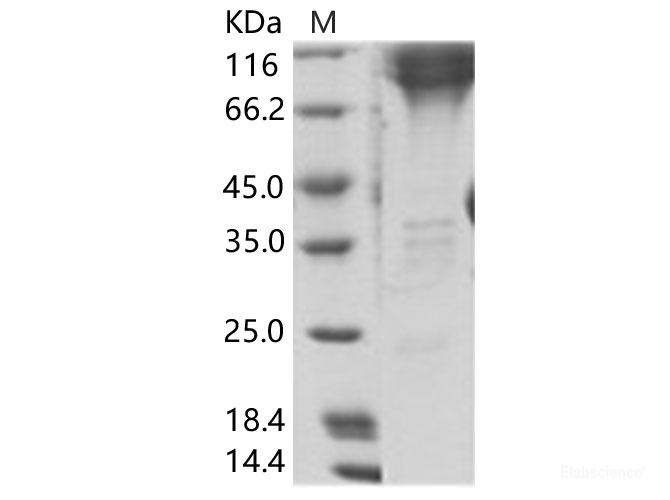 Recombinant EBOV (subtype Zaire, strain H.sapiens-wt/GIN/2014/Kissidougou-C15) GP2 / Glycoprotein Protein (Fc Tag)