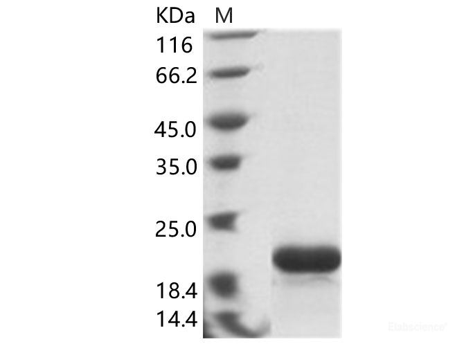 Recombinant EBOV (subtype Zaire, strain H.sapiens-wt/GIN/2014/Kissidougou-C15) Nucleoprotein / NP Protein (His Tag)