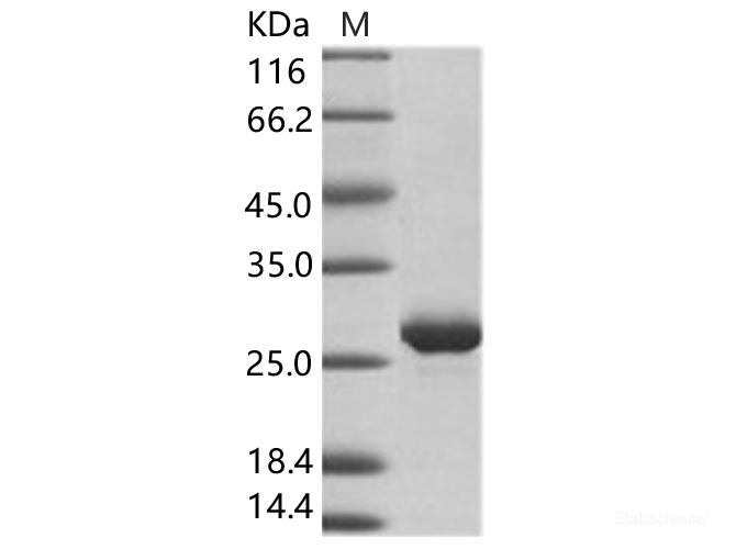 Recombinant EBOV (subtype Zaire, strain H.sapiens-wt/GIN/2014/Kissidougou-C15) VP24 Protein (His Tag)