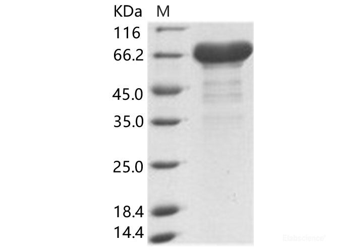 Recombinant EBOV (subtype Zaire, strain H.sapiens-wt/GIN/2014/Kissidougou-C15) VP40 / Matrix protein VP40 Protein (His & MBP Tag)