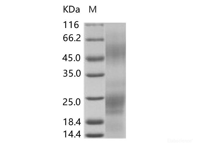 Recombinant EBOV (subtype Zaire, strain H.sapiens-wt/SLE/2014/ManoRiver-G3686.1) Glycoprotein Protein (His Tag)