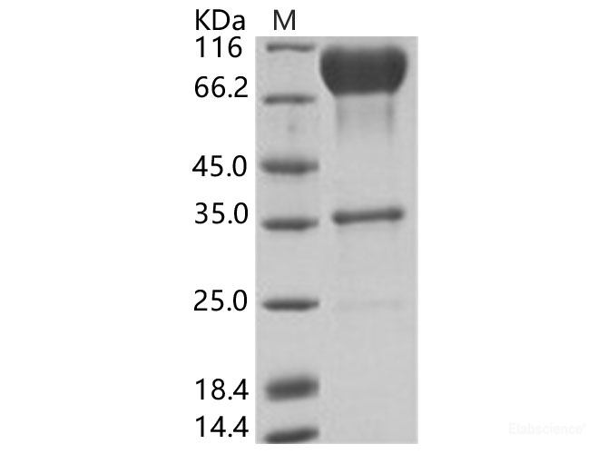 Recombinant EBOV (subtype Zaire, strain Mayinga 1976) Glycoprotein / GP-RBD Protein (Fc Tag)