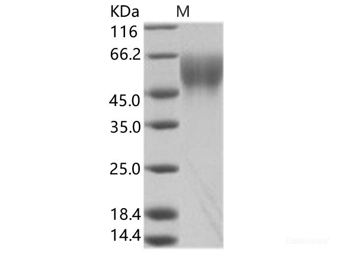 Recombinant EBOV (subtype Zaire, strain Mayinga 1976) GP-RBD / Glycoprotein Protein