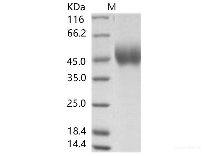 Recombinant EBOV (subtype Zaire, strain Mayinga 1976) GP-RBD / Glycoprotein Protein (His Tag)