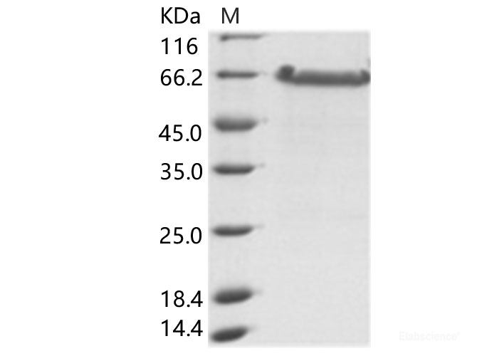 Recombinant EBOV (Sudan ebolavirus, strain Gulu) Nucleoprotein / NP (aa361-aa738) Protein (His Tag)