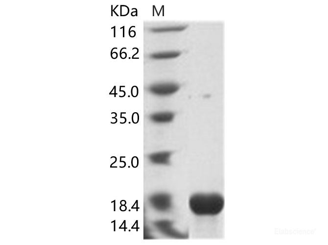 Recombinant EBOV (Sudan ebolavirus, strain Gulu) Nucleoprotein / NP Protein (His Tag)
