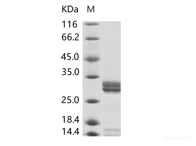Recombinant Enterovirus D68 (EV-D68) (strain Fermon) VP4 Protein (Fc Tag)