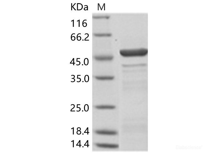 Recombinant Hantaan virus HTNV (strain 84FLi) Nucleocapsid / NP Protein (His Tag)