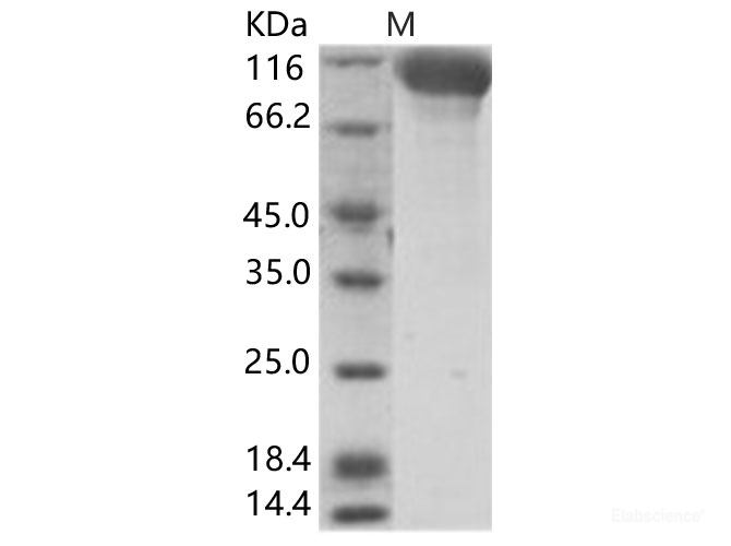 Recombinant Hendra virus (HeV) (isolate Horse/Autralia/Hendra/1994) Glycoprotein Protein (Fc Tag)