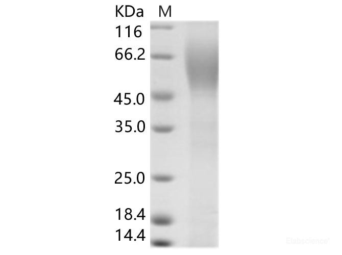 Recombinant HCV (serotype 1b, isolate HC-J4) Envelope / E2 Protein (His Tag)