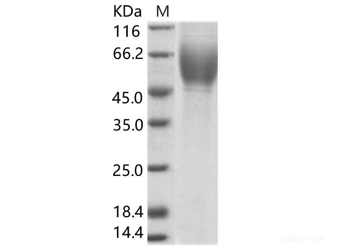 Recombinant HCV (serotype 1c,isolate HC-G9) E2 Protein (His Tag)