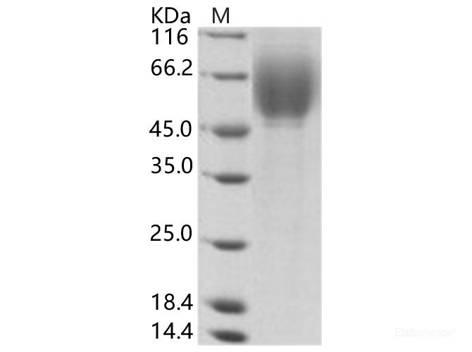 Recombinant HCV (HCV-1a) E2 Protein (His Tag)