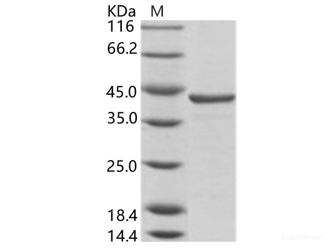 Recombinant HCV (HCV-1a) NS3 protease / helicase immunodominant region Protein (aa 1356-1459, GST Tag)